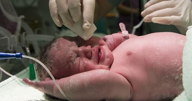 7 Hal yang Sering Terjadi pada Bayi Lahir Prematur